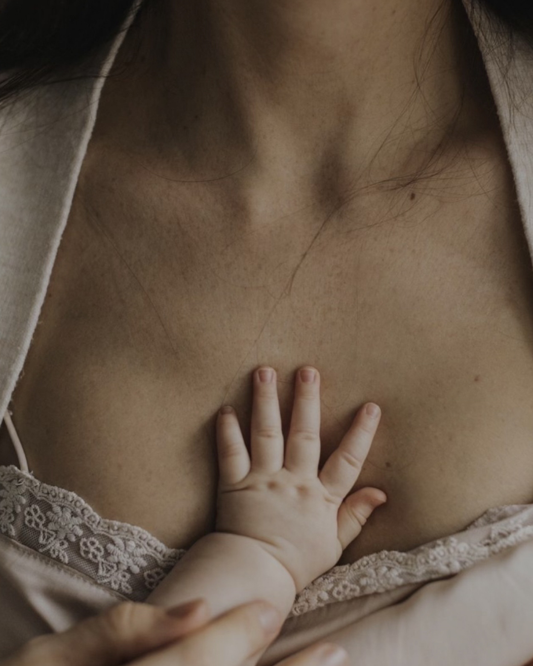 Mastitis