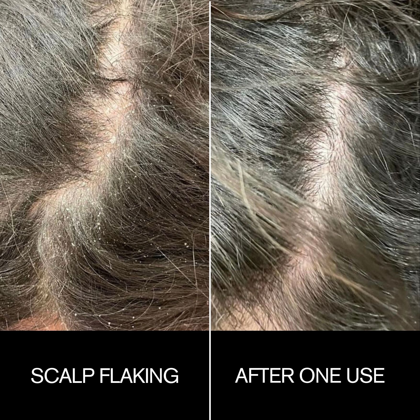 Scalp Mask