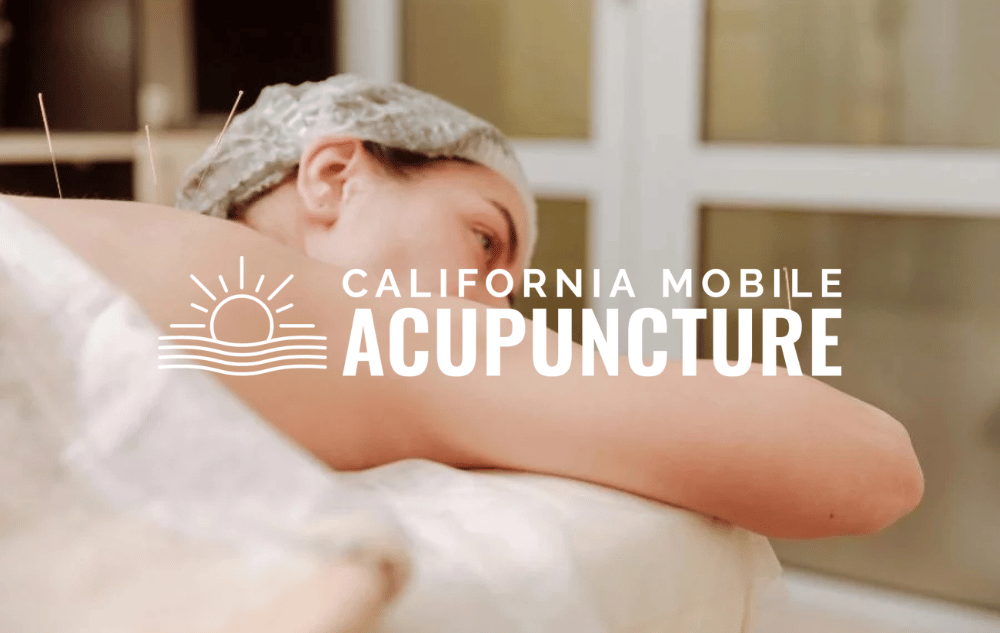 California Mobile Acupuncture