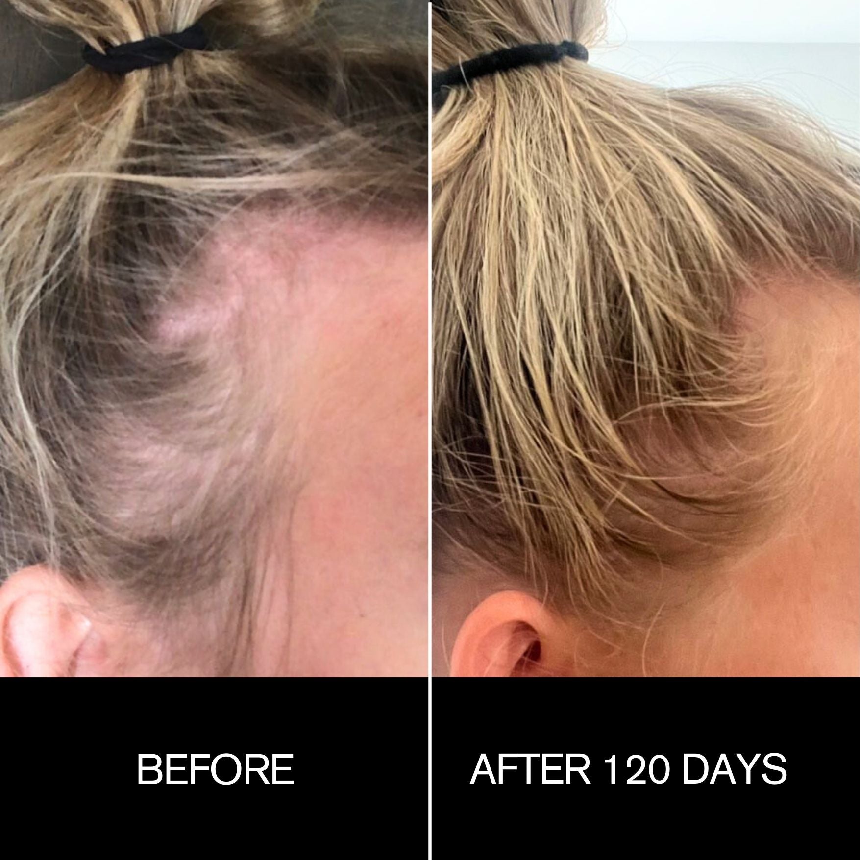 Follicle Drops