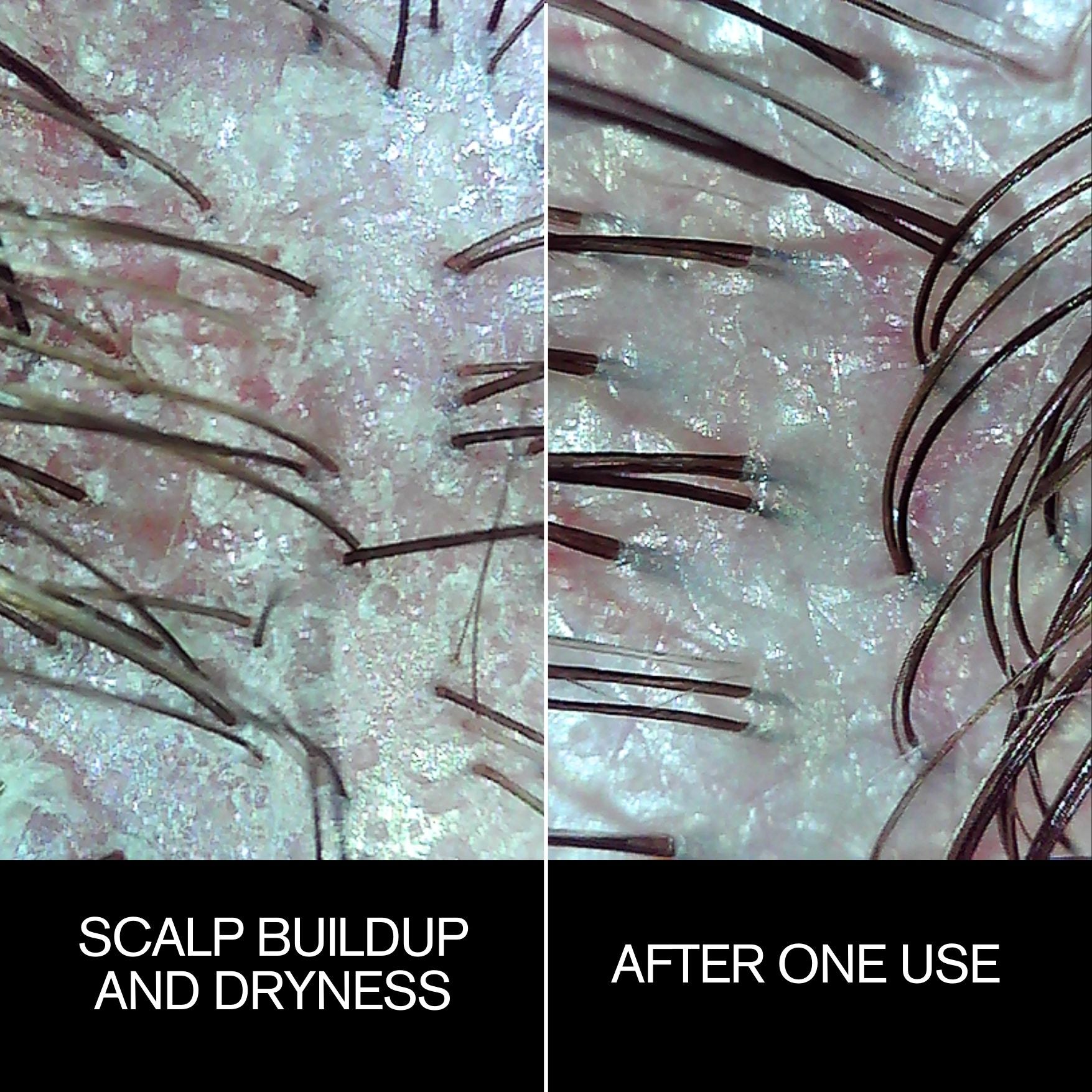 Follicle Drops